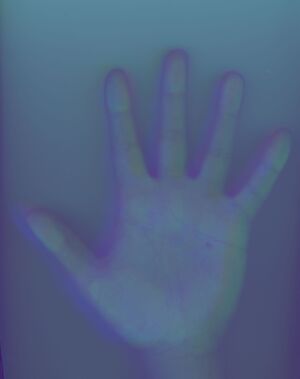Trichrome hand.jpg